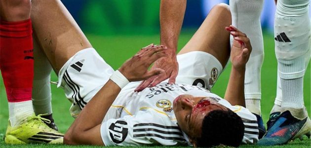 ريال مدريد يُشعل حربًا جديدة: تفاصيل موقف ريال مدريد التصعيدي ضد التحكيم الإسباني بعد موقعة جيرونا